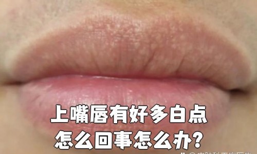 出汗异常是神经损伤不可逆吗-出汗异常是神经损伤不可逆吗专区_出汗是什么神经兴奋专区_出汗有哪些脑神经支配网